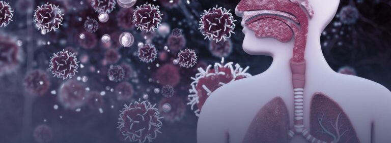 Upper respiratory infection