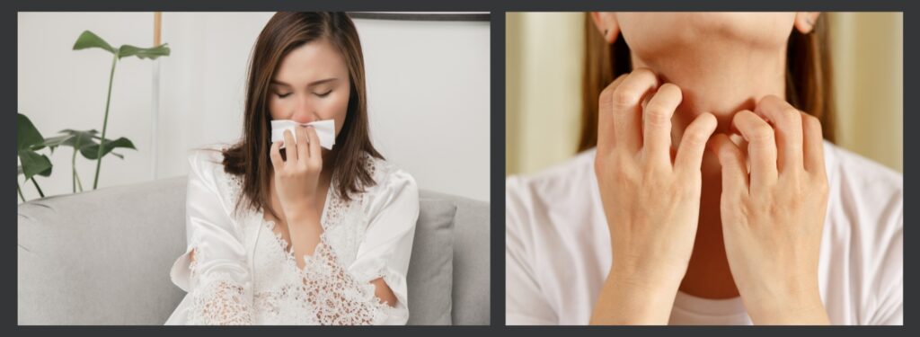 allergy reaction symptoms