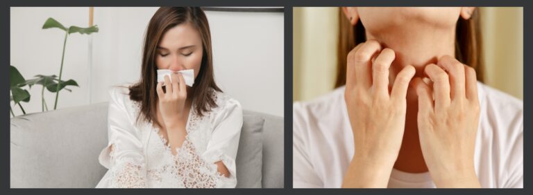 allergy reaction symptoms