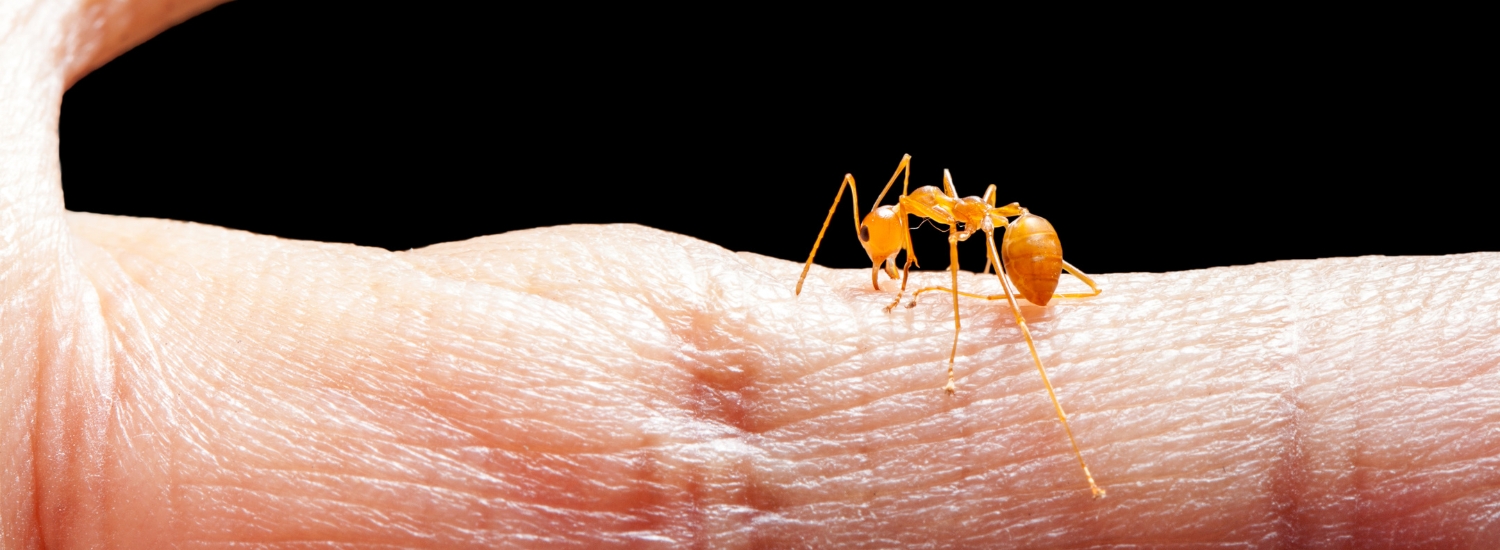 How to Treat Ant Bites