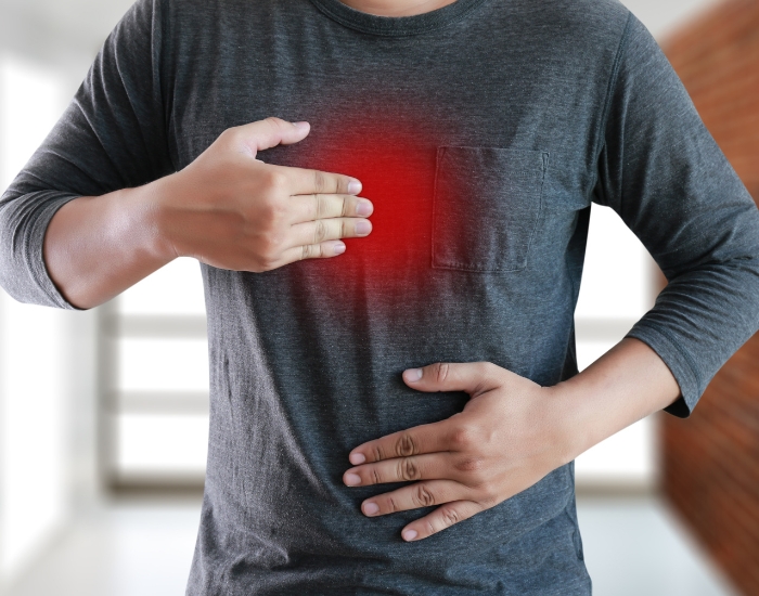 Can acid reflux feel like chest pain?