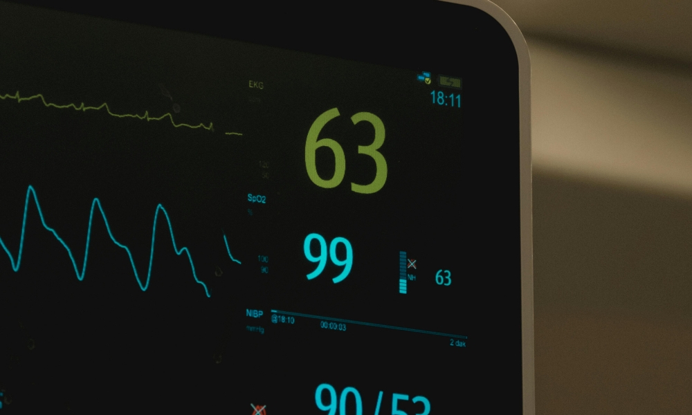 Comparison of anxiety-related palpitations and arrhythmia evaluation using hospital heart monitoring equipment